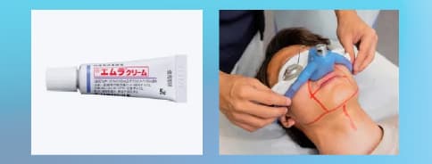 麻酔施術の画像